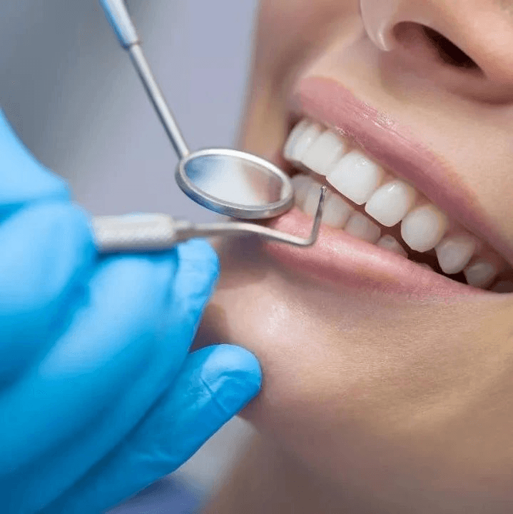 Teeth Whitening